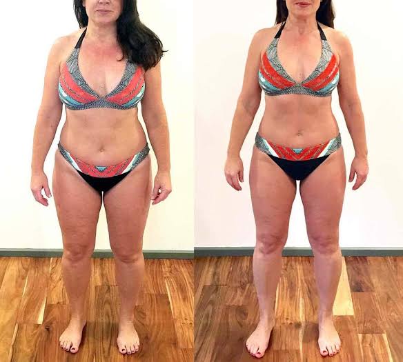 Carol, 56 before and after